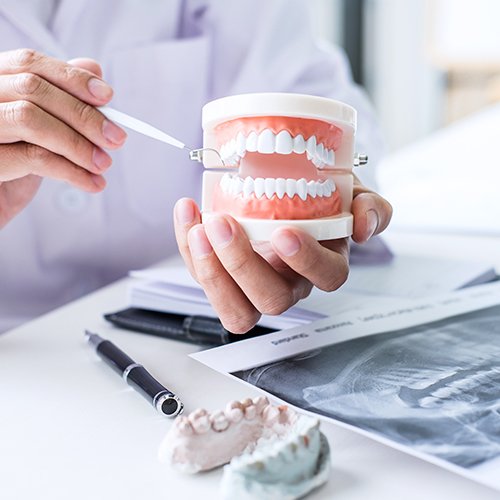Bone Grafting