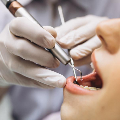 Gum Surgery