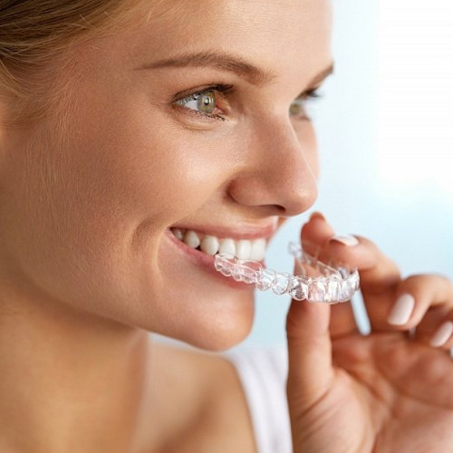 Invisalign