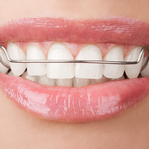 Retainers