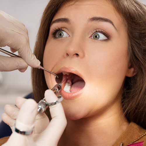 Wisdom Teeth Removal